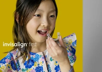 Young child placing an Invisalign First aligner